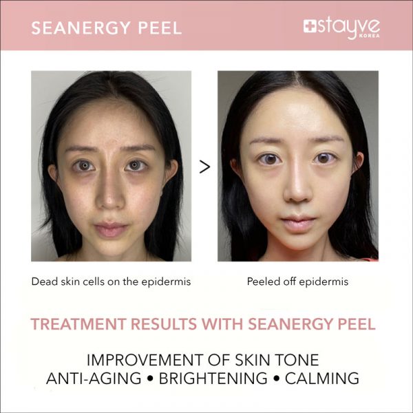 Stayve Seanergy Peel Course Online + One Seanergy Peel Treatment image 4