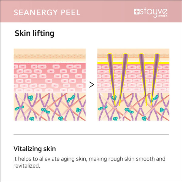 Stayve Seanergy Peel Course Online + One Seanergy Peel Treatment image 8