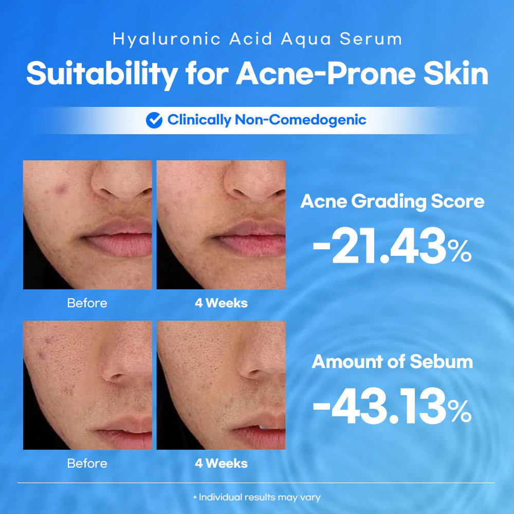 Lesimo Hyaluronic Acid Aqua Serum image 6
