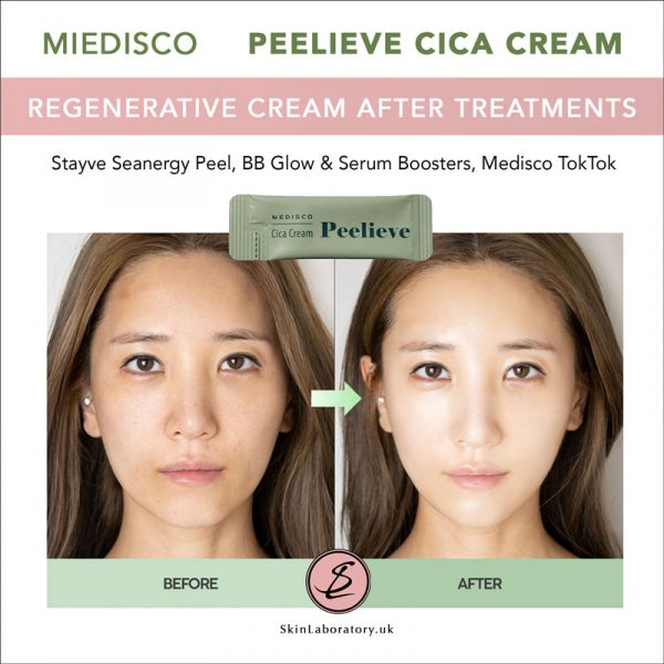 Medisco Peelieve Cica Cream image 5
