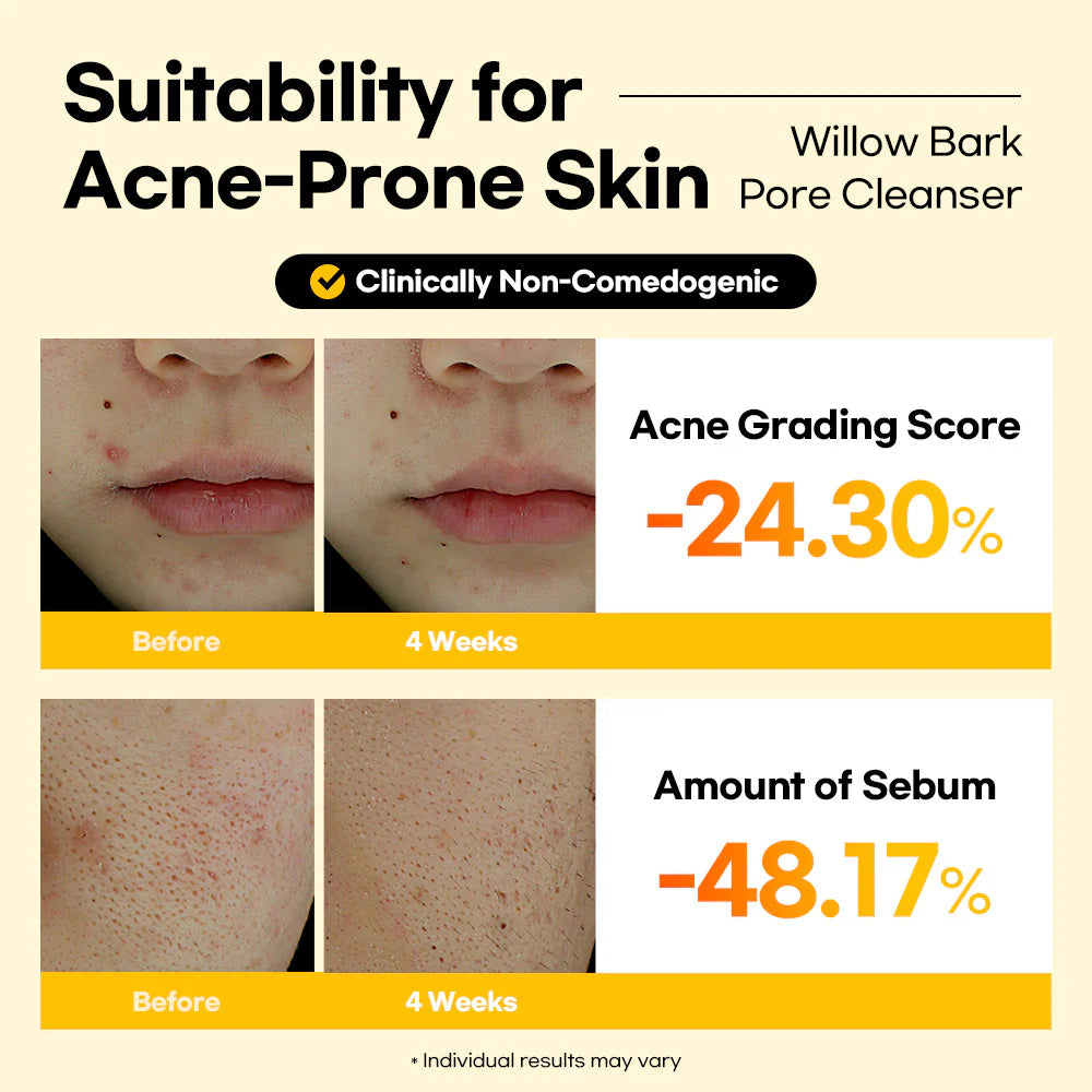 Lesimo Willow Bark Pore Cleanser image 5
