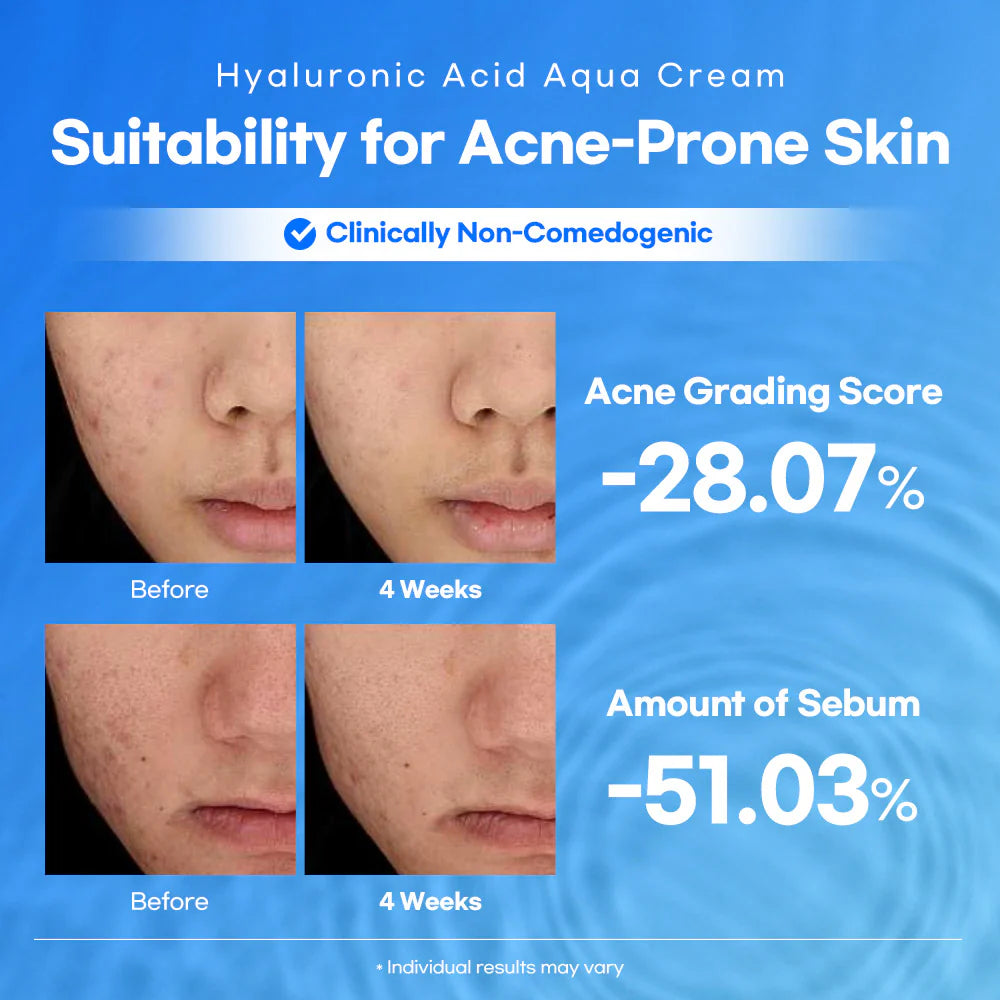 Lesimo Hyaluronic Acid Aqua Cream image 3