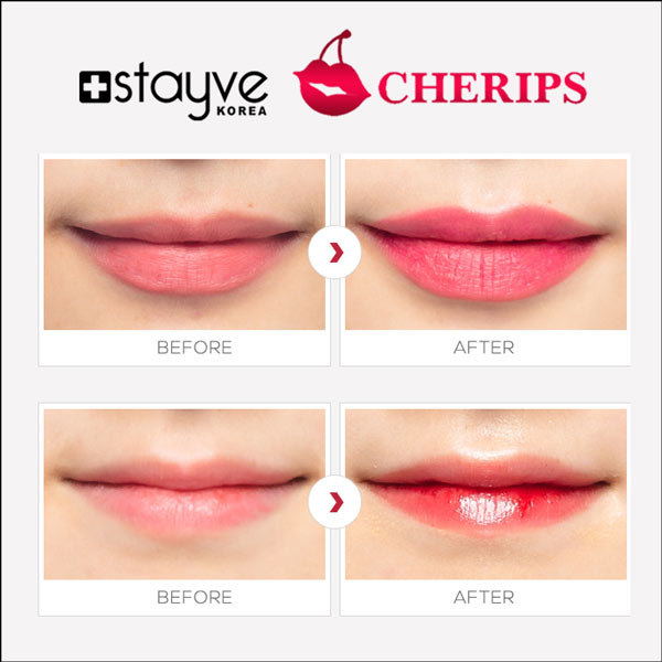 Stayve Cherips Micro-needling Ampoules Set for Lips (Copy) image 4