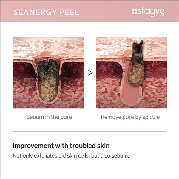 Stayve Seanergy Peel - 2 boxes + Online Course image 9
