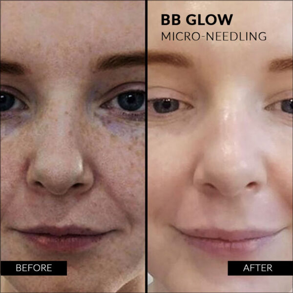 Stayve BB Glow Starter kit image 11