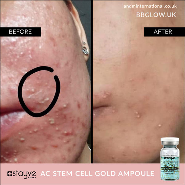 Stayve Booster Serum - AC Stem Cell Gold Ampoule image 4