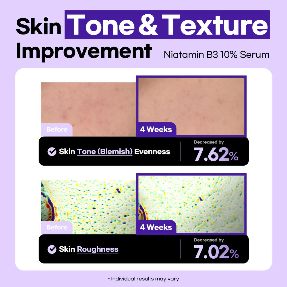 Lesimo Niatamin B3 10% Serum image 5