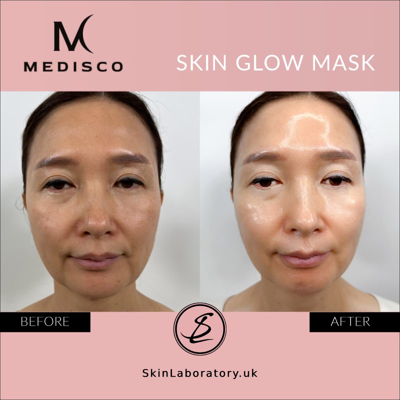 Medisco Skin Glow Mask image 9