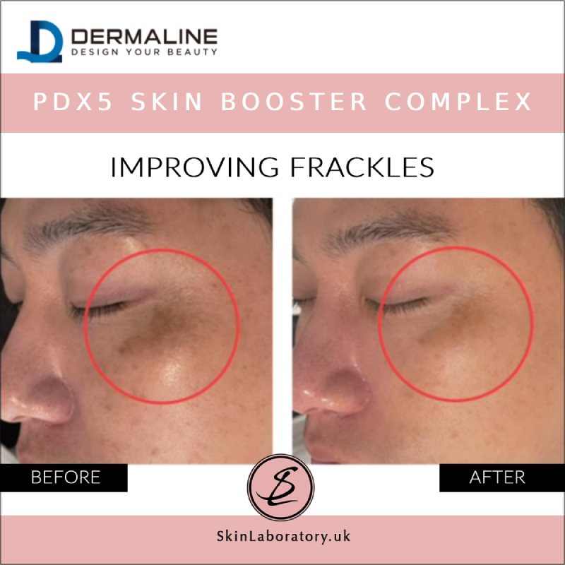 DERMALINE PDX5 Skin Booster Complex image 6