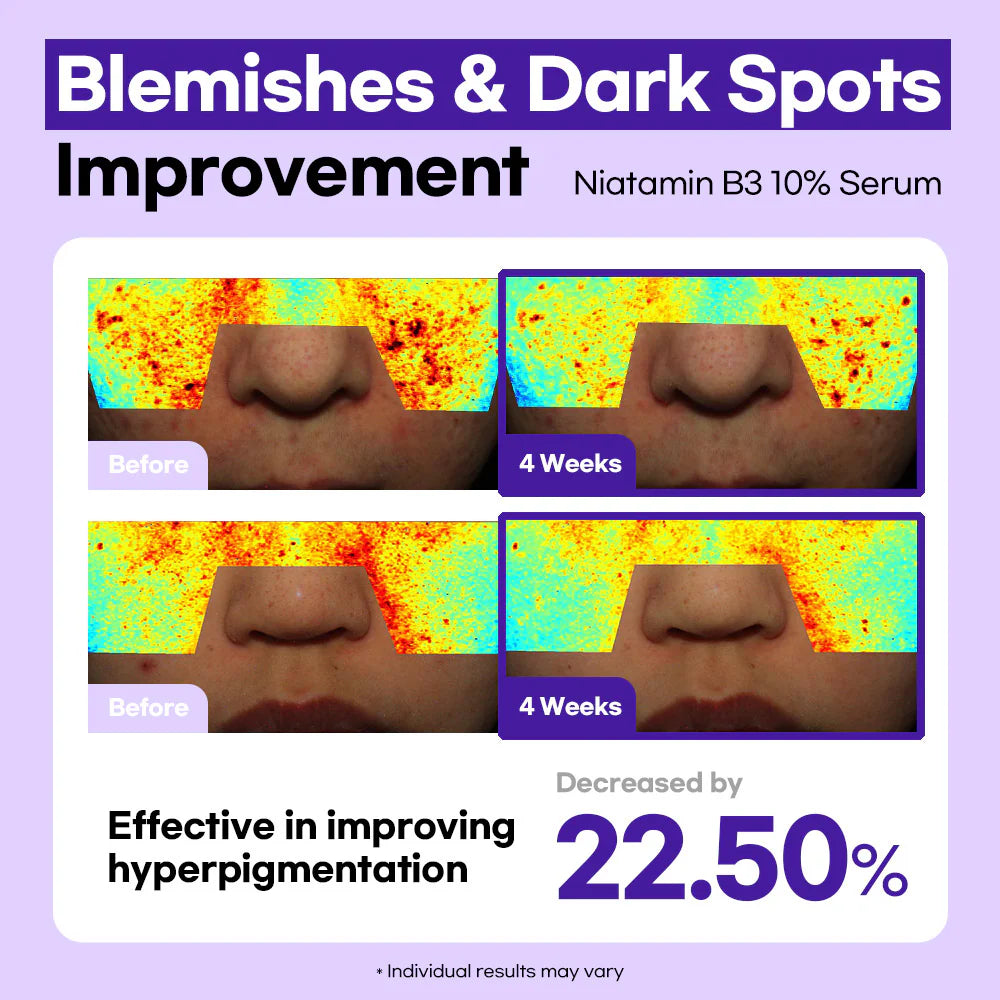 Lesimo Niatamin B3 10% Serum image 6