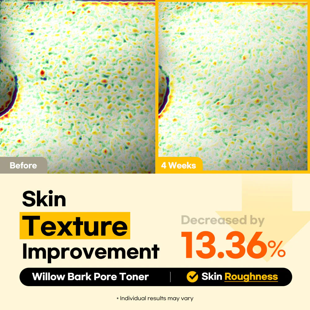 Lesimo Willow Bark Pore Toner image 5