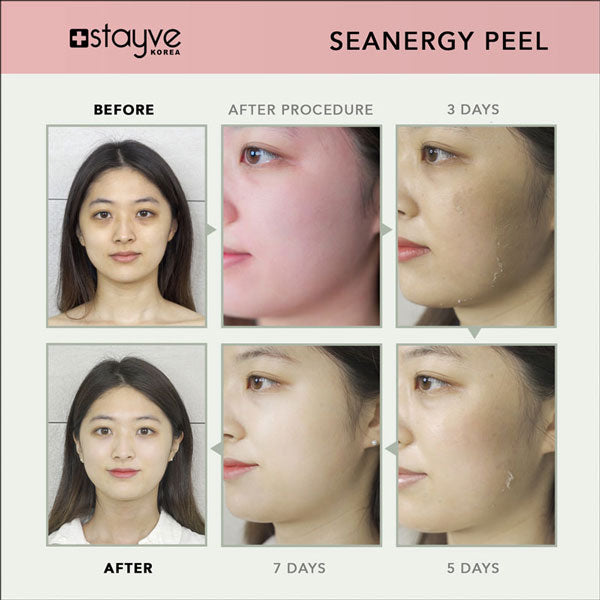 Stayve Seanergy Peel - 2 boxes + Online Course image 7