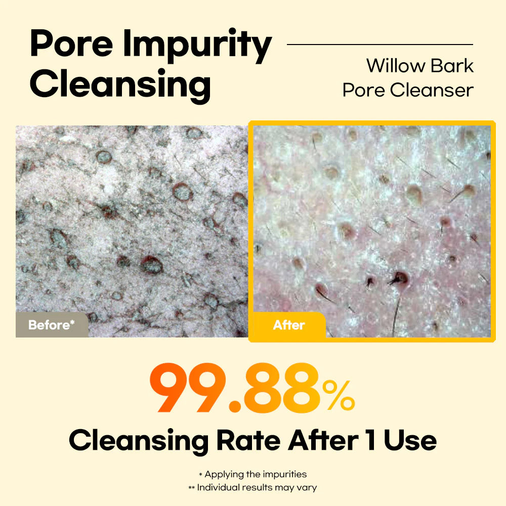 Lesimo Willow Bark Pore Cleanser image 7