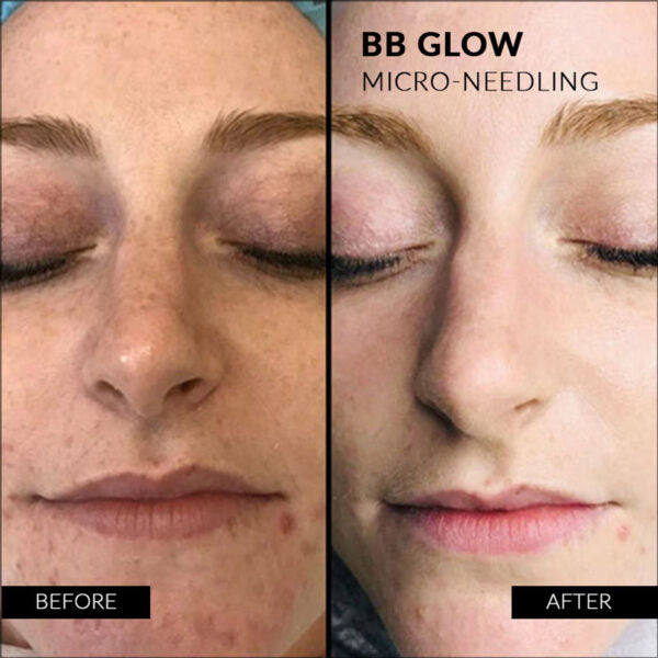 Stayve BB Glow Starter kit image 12