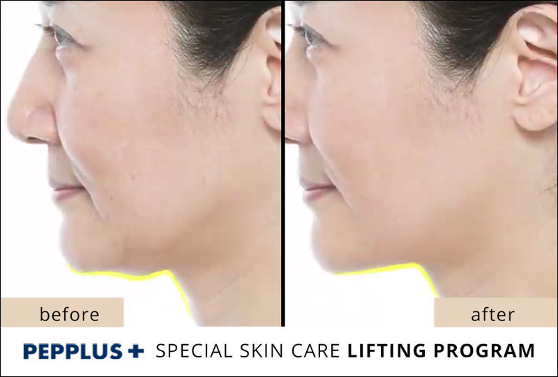 PicoBio PEPPLUS+ SUPER SkinCare Lifting Program - 10 treatments & wrinkle cream image 10