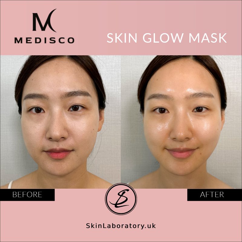 Medisco Skin Glow Mask image 10