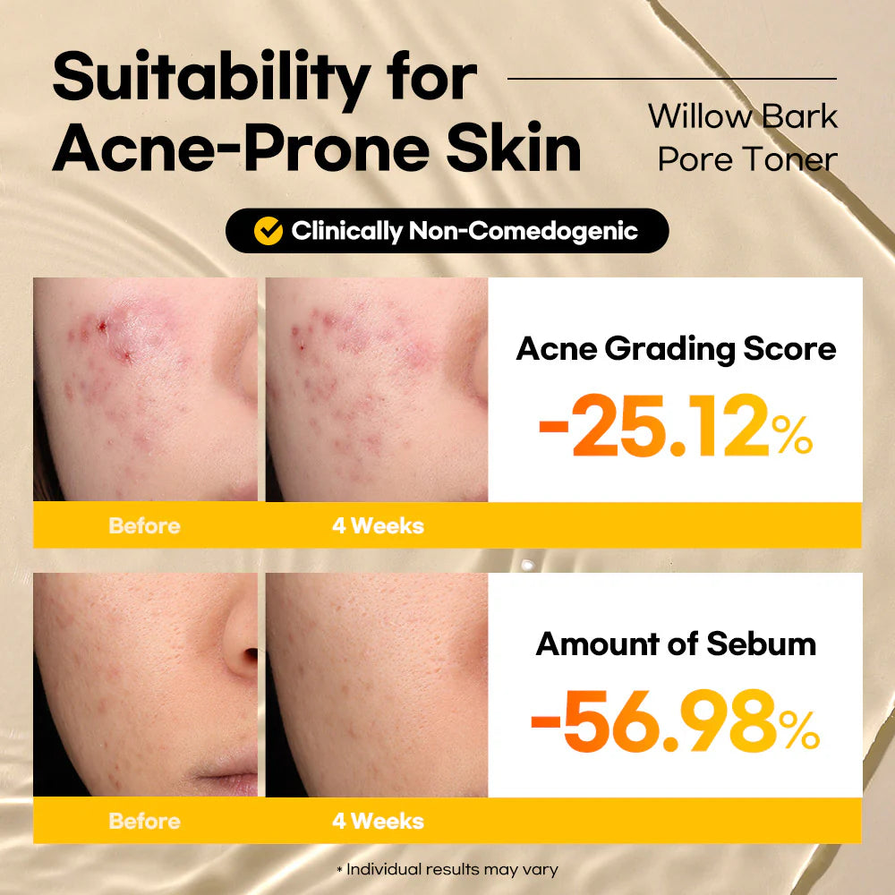 Lesimo Willow Bark Pore Toner image 7