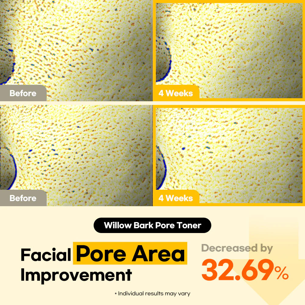 Lesimo Willow Bark Pore Toner image 6