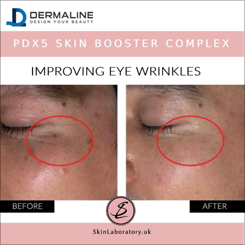 DERMALINE PDX5 Skin Booster Complex image 5