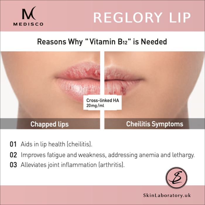 Medisco Reglory Lip Filler image 3