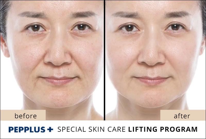 PicoBio PEPPLUS+ SUPER SkinCare Lifting Program - 10 treatments & wrinkle cream image 11