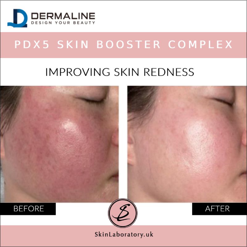 DERMALINE PDX5 Skin Booster Complex image 4