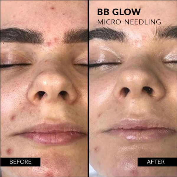 Stayve BB Glow Starter kit image 14
