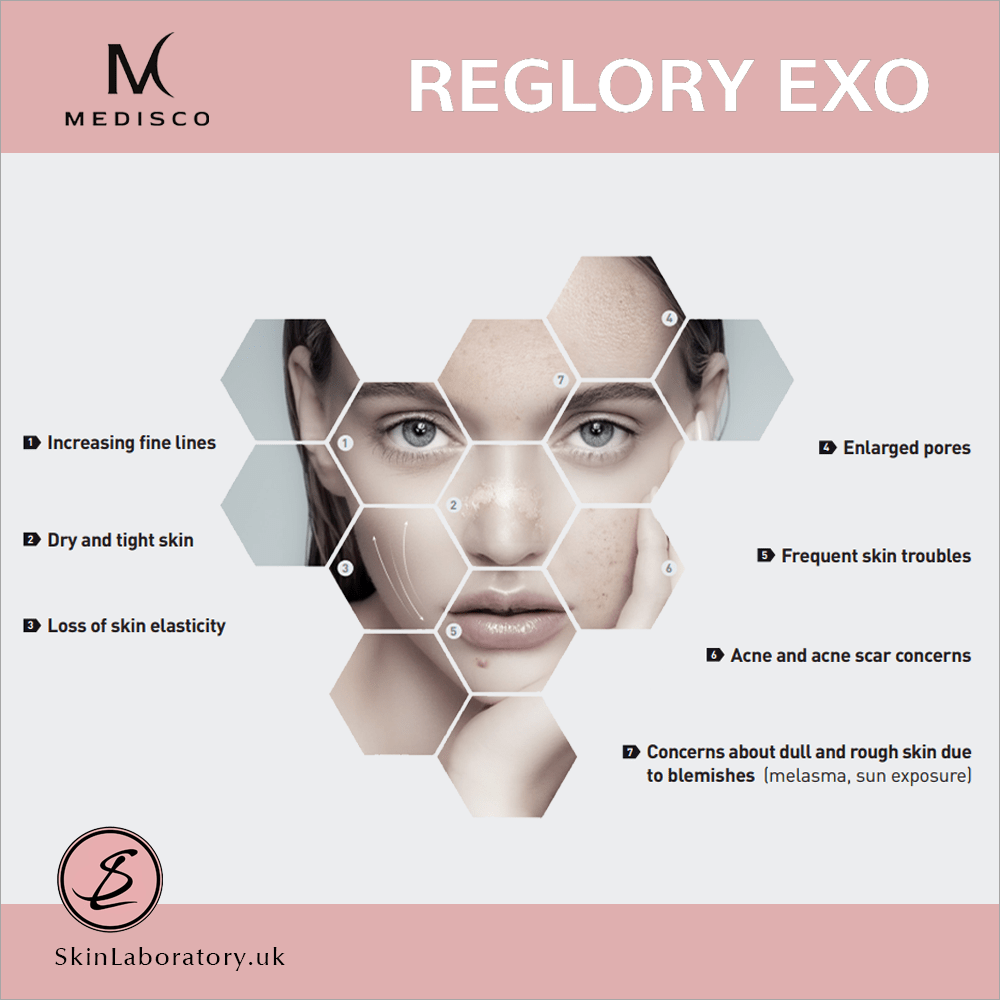 Medisco Reglory EXO image 2